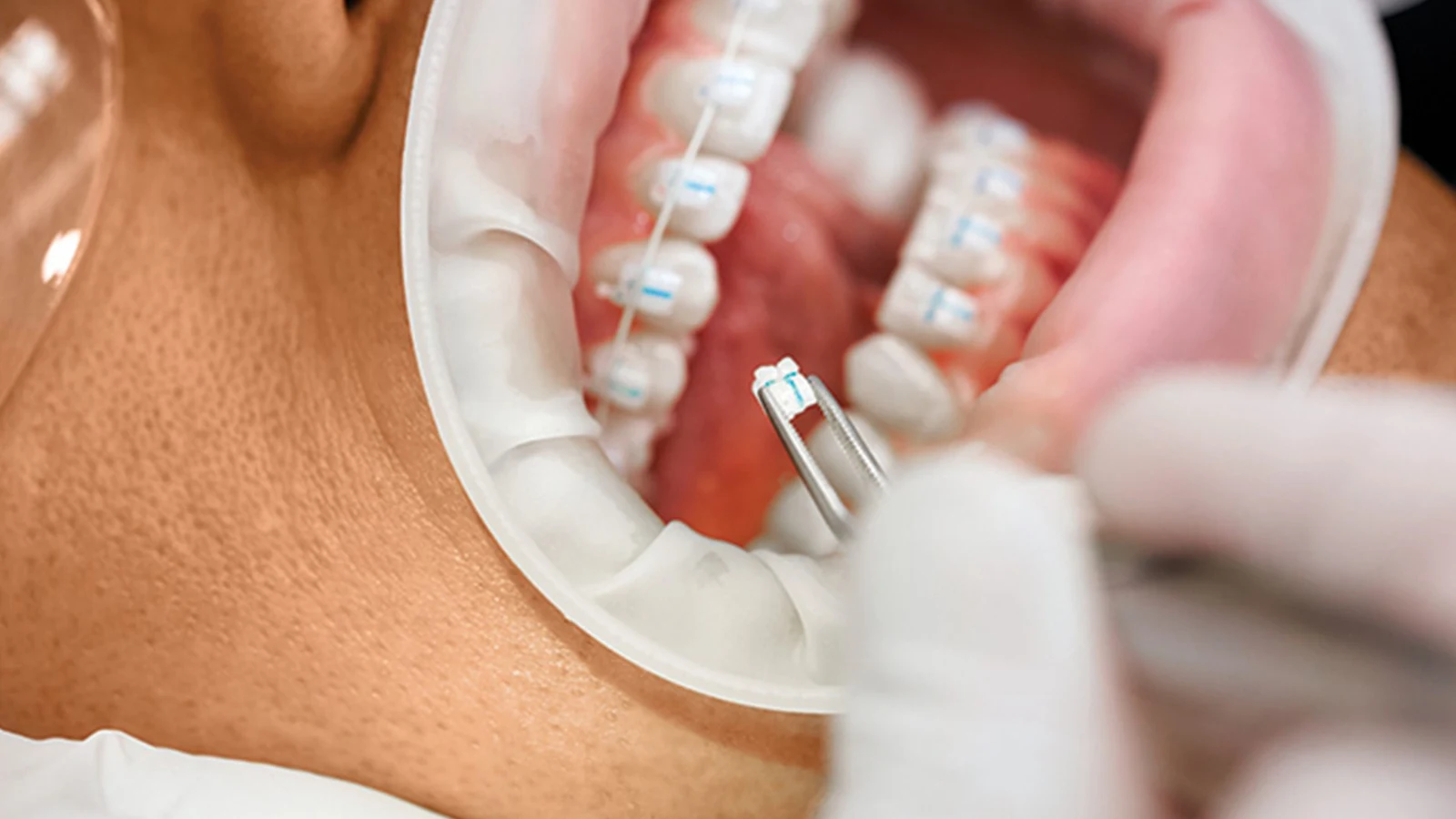 Clinical Outcomes, Patient Safety & Protocols