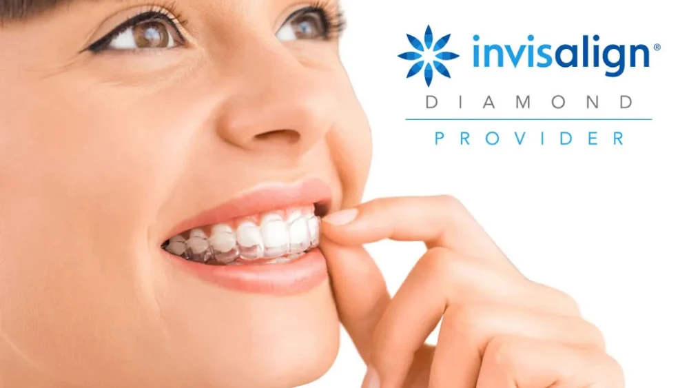 Teeth Straightening (legacy)