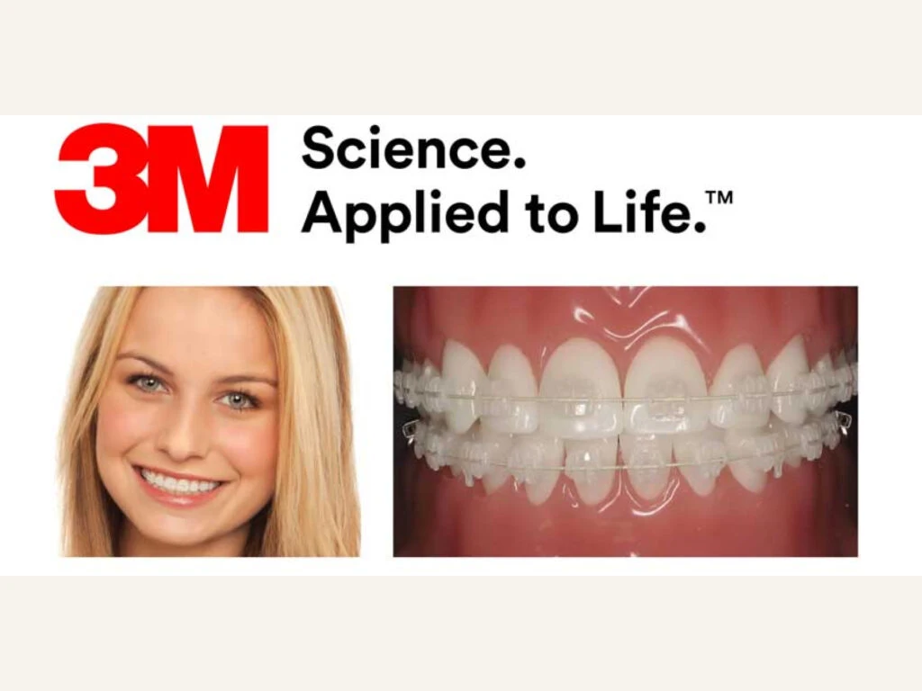 Teeth Straightening (legacy)