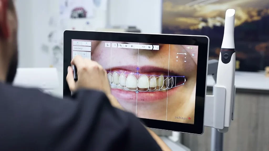 digital-smile-design