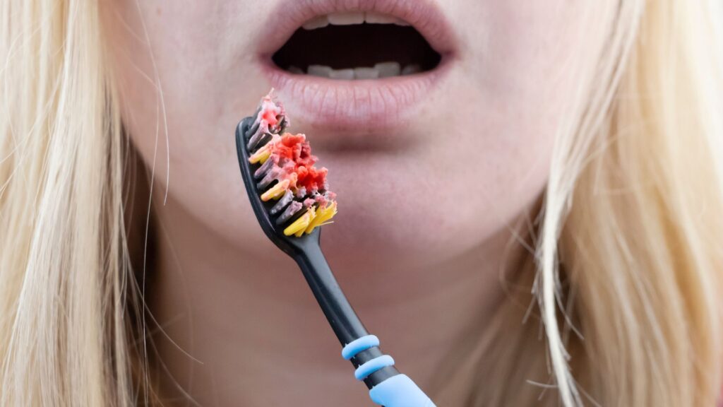 bleed-gums-when-brushing