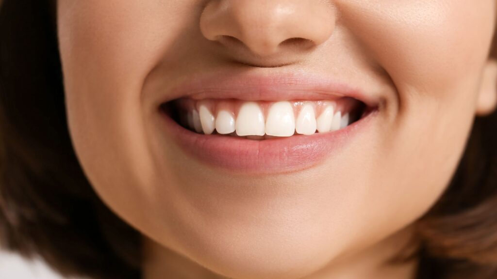 healthy gums